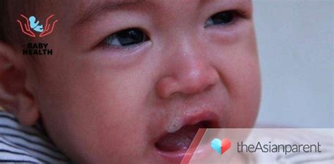 Gamot Sa Sipon Ng Baby: Mga Dapat Gawin Kapag .